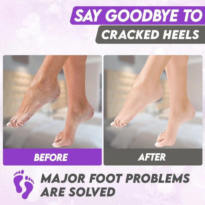 Karma Naturals lavender Foot Peel Mask