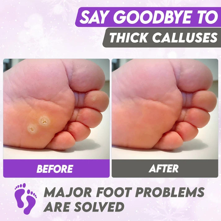 Karma Naturals lavender Foot Peel Mask