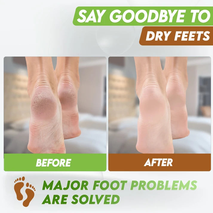 Karma Naturals coconut Foot Peel Mask