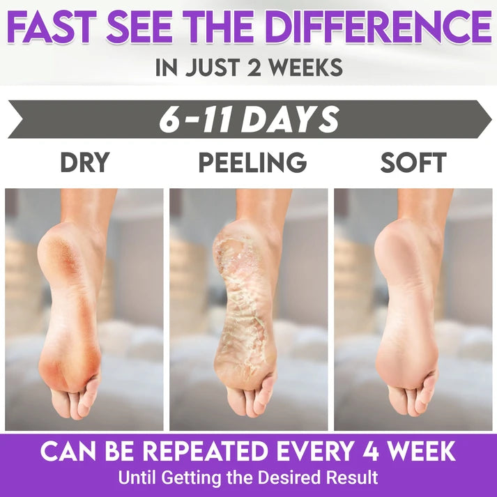 Karma Naturals lavender Foot Peel Mask